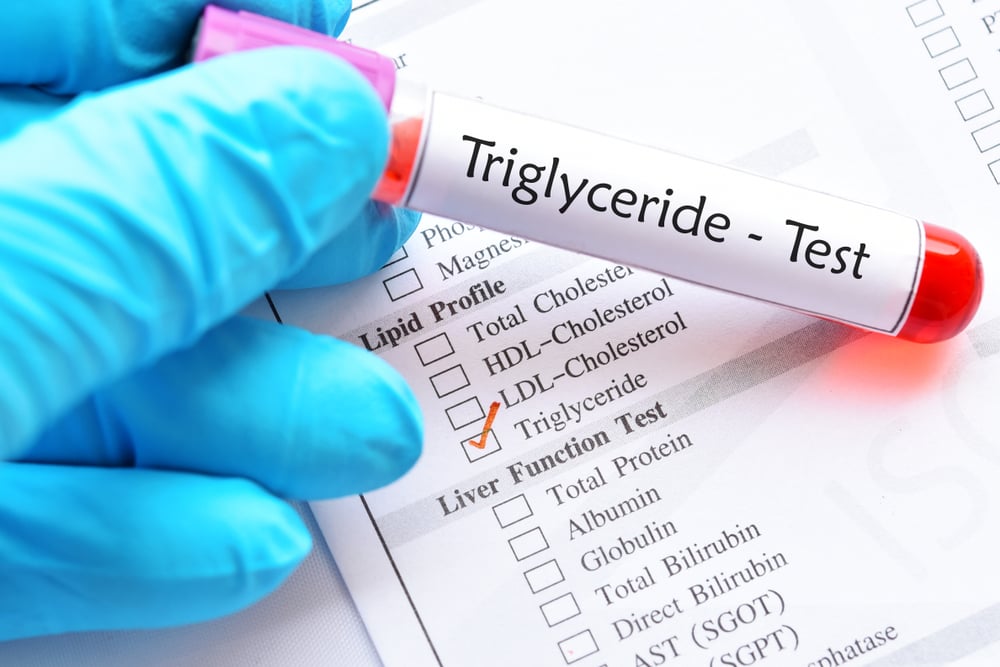  Định lượng Triglycerid: Vai trò quan trọng trong sức khỏe tim mạch