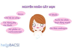  Giải quyết mụn đỏ sưng tấy: Nguyên nhân, triệu chứng và phương pháp điều trị hiệu quả