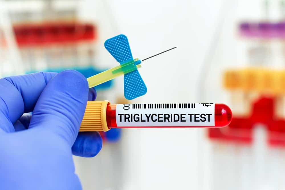  Định lượng Triglycerid: Vai trò quan trọng trong sức khỏe tim mạch