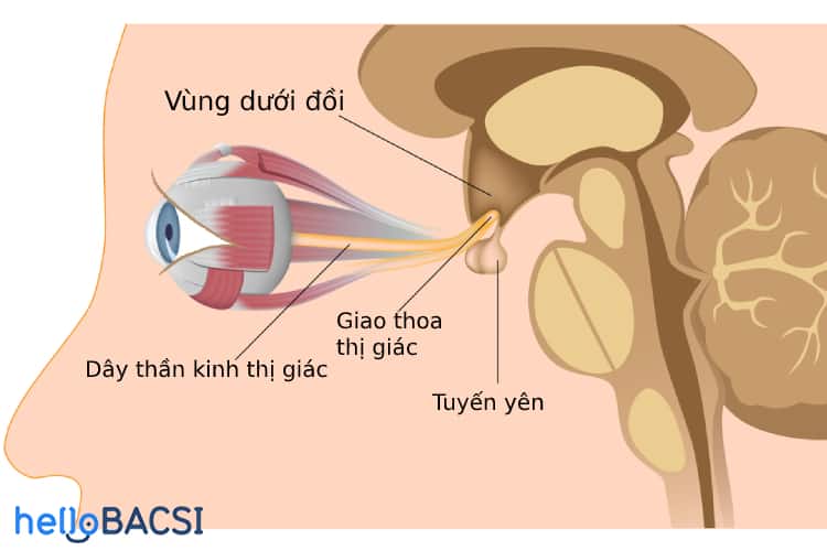  Ung thư Tuyến Yên: Tổng Quan Toàn Diện