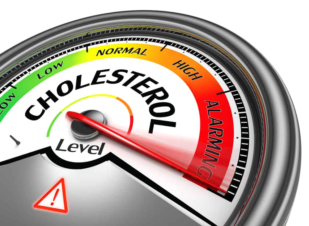  HDL Cholesterol: Lợi ích và Rủi ro của Chỉ số Cao