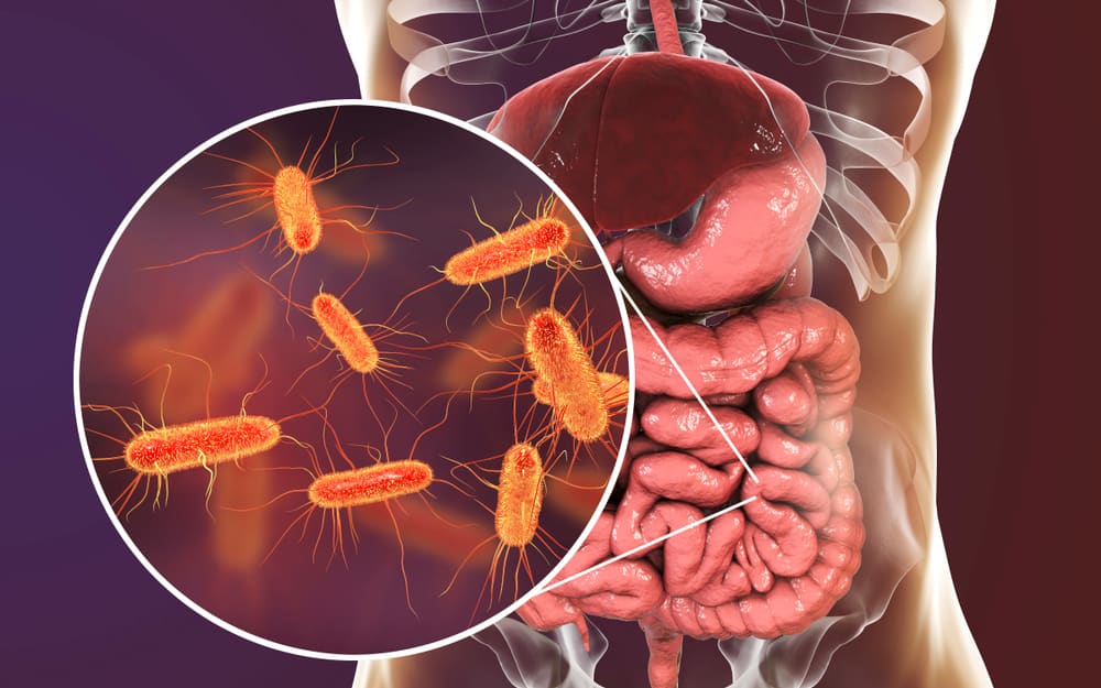  Nhiễm khuẩn E. coli: Triệu chứng, Nguyên nhân, Điều trị và Phòng ngừa