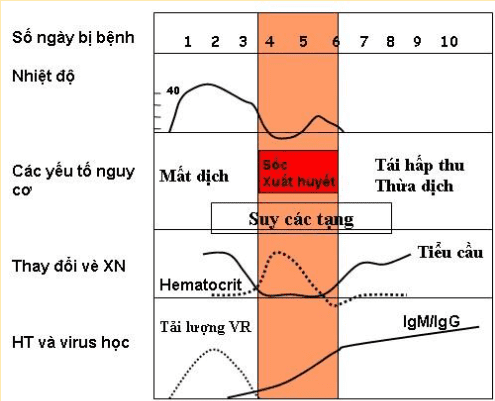  Sốt xuất huyết: Giai đoạn, dấu hiệu cảnh báo và cách xử trí