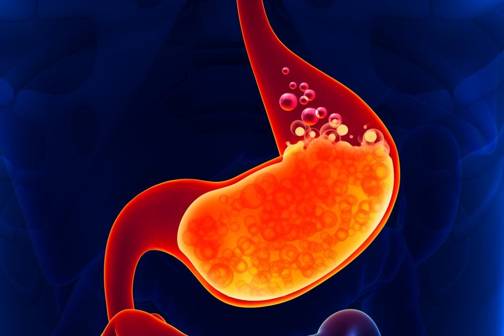  Gaviscon: Một hướng dẫn toàn diện về thuốc trào ngược dạ dày - thực quản