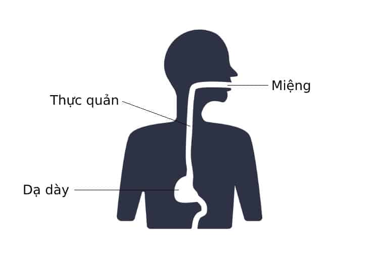  Thủng thực quản: Nguyên nhân, Triệu chứng, Chẩn đoán và Điều trị