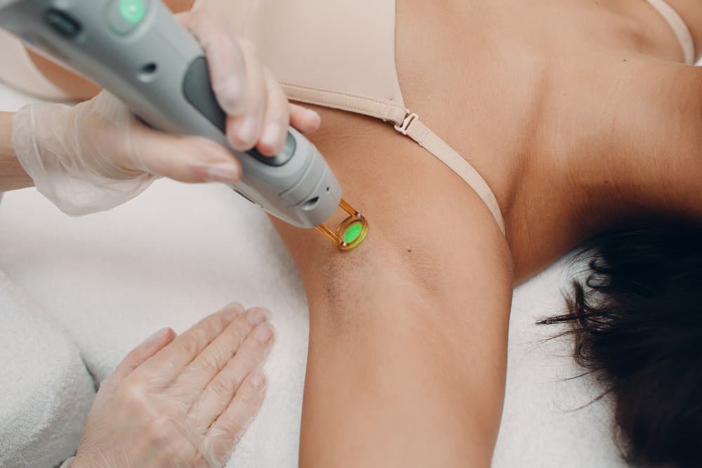  Trị Thâm Nách Bằng Laser: Giải Pháp Nhanh Chóng và Hiệu Quả Cho Vùng Da Dưới Cánh Tay Trắng Mịn