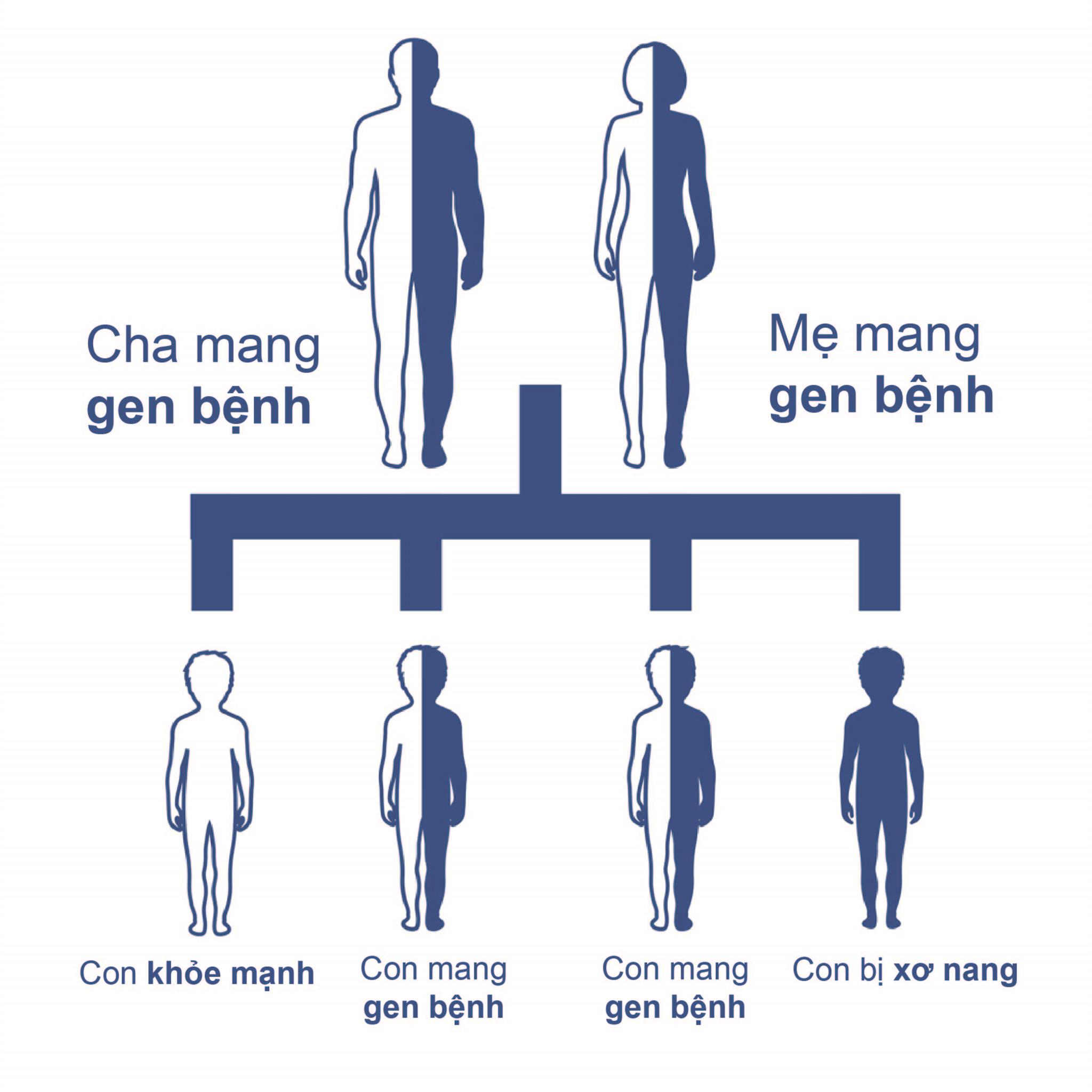  Xơ nang ở trẻ nhỏ: Nguyên nhân, triệu chứng và các biện pháp điều trị