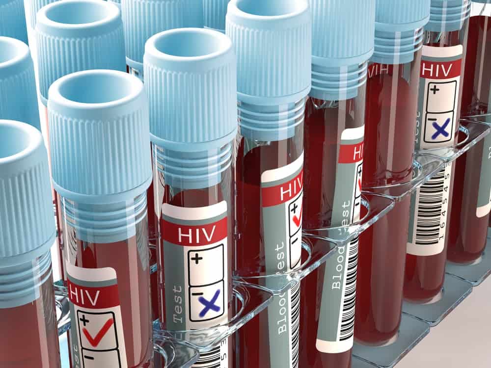  Bệnh HIV/AIDS: Hướng dẫn toàn diện