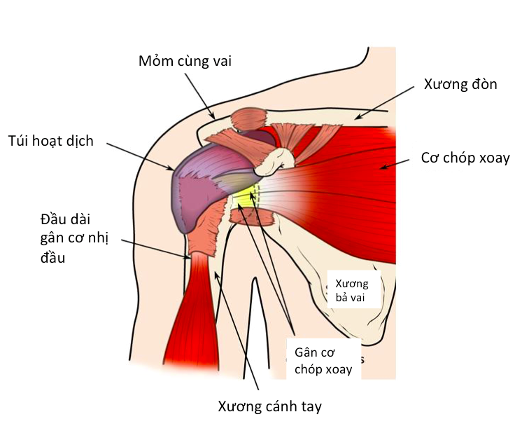  Giải mã cơn đau vai: Nguyên nhân, triệu chứng và cách điều trị