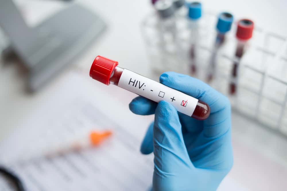  Bệnh HIV: Triển vọng điều trị và cách phòng ngừa lây nhiễm