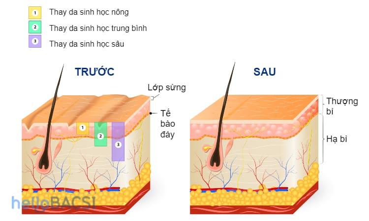  Phương Pháp Trị Thâm Mụn Hiệu Quả: 10 Giải Pháp Từ Không Kê Đơn Đến Chuyên Sâu