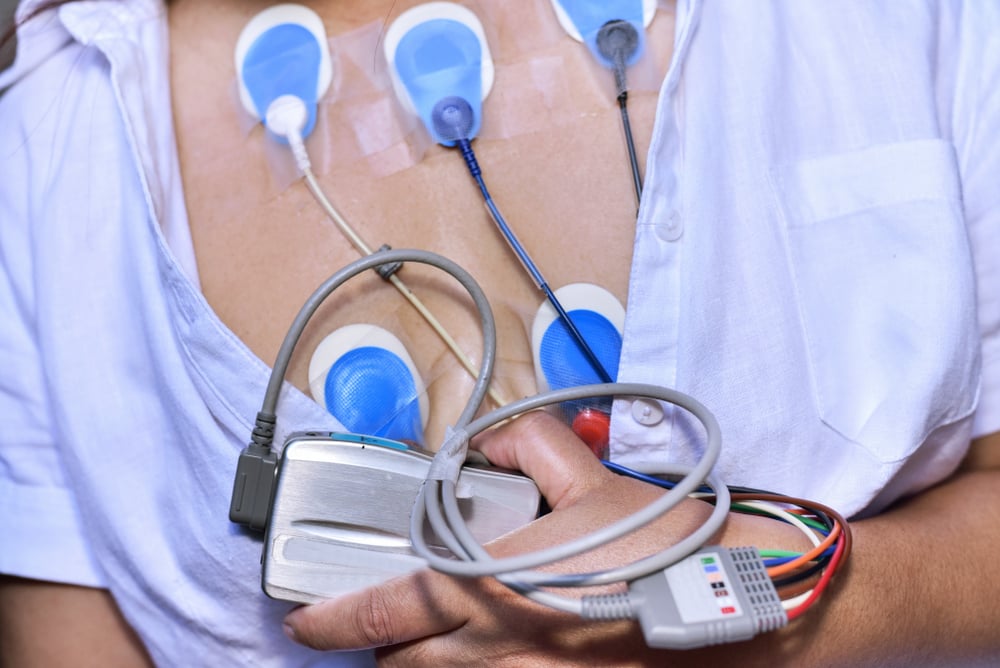  Điện tâm đồ lưu động (Holter ECG): Hướng dẫn toàn diện