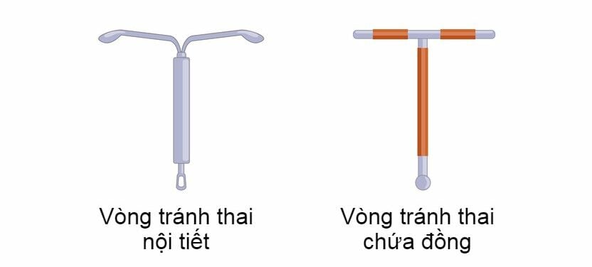  Đặt Vòng Tránh Thai: Lợi Ích, Rủi Ro và Ai Không Nên Sử Dụng