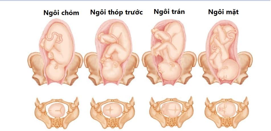  Ngôi thai thuận: Dấu hiệu, Cách nhận biết và Giải pháp nếu bé không quay đầu