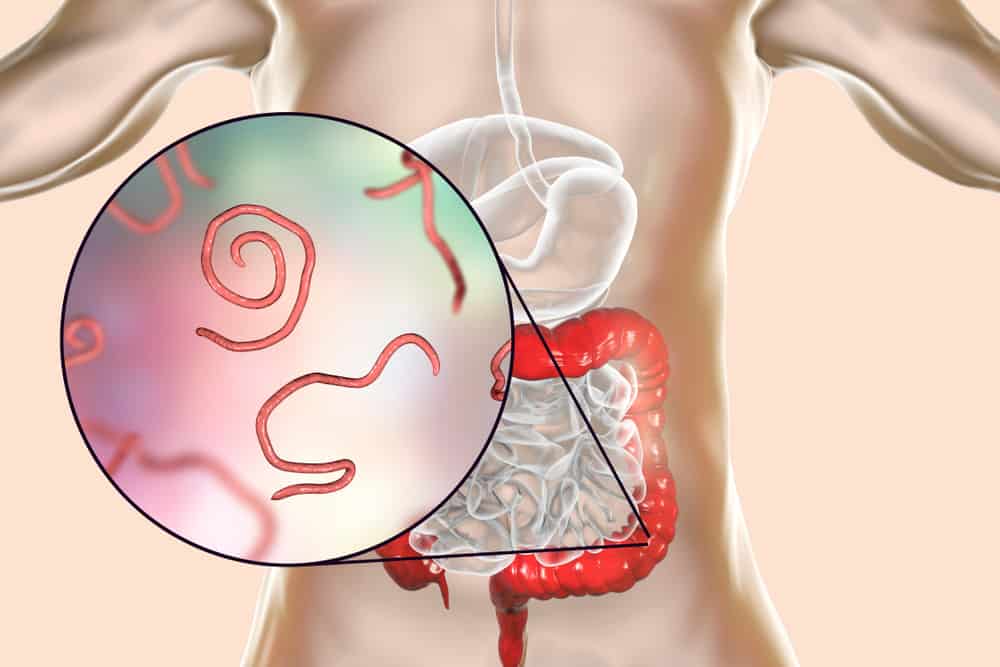  Nhiễm Giun Sán Ở Người Lớn: Dấu Hiệu, Nguyên Nhân và Cách Xử Trí