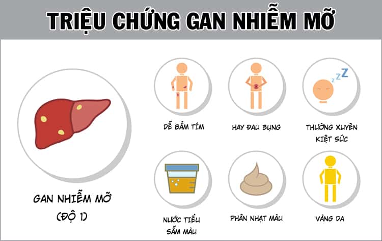  Gan nhiễm mỡ độ 1: 10 thói quen đơn giản để cải thiện sức khỏe gan