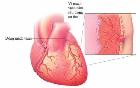  Triệu chứng thiếu máu cơ tim: Nhận biết và cải thiện sớm