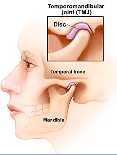  Rối loạn khớp thái dương hàm: Nguyên nhân, Triệu chứng và Phương pháp điều trị