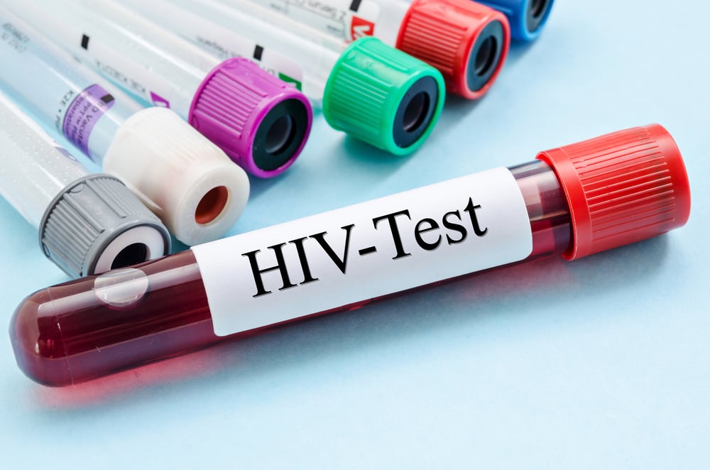 ### Tình trạng nhiễm HIV và những điều cần biết