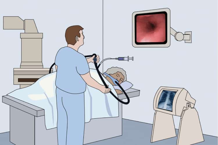  Nội soi mật tụy ngược dòng (ERCP): Hướng dẫn toàn diện