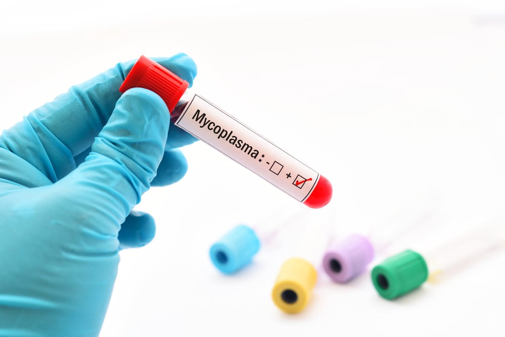  Viêm phổi do Mycoplasma: Nguyên nhân, Triệu chứng và Biện pháp Phòng ngừa