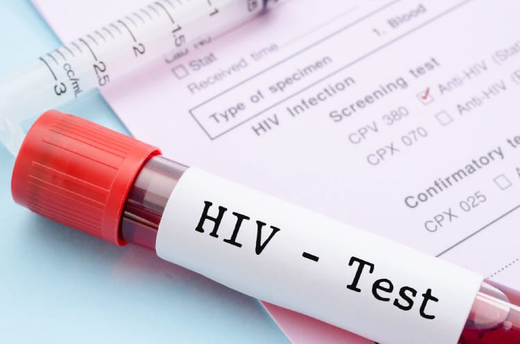  Hướng dẫn toàn diện về HIV/AIDS ở trẻ em: Nguyên nhân, triệu chứng, chẩn đoán và điều trị