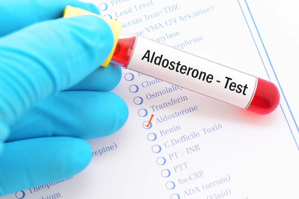  Xét nghiệm Aldosterone: Tổng quan, Quy trình và Giải thích Kết quả