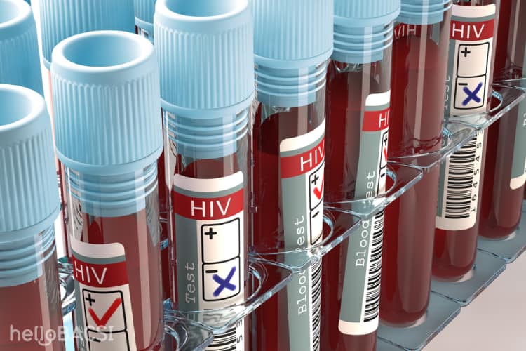  Hướng dẫn toàn diện về xét nghiệm HIV