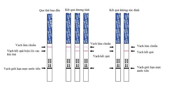  Hướng dẫn toàn diện về cách sử dụng que thử thai và đọc kết quả