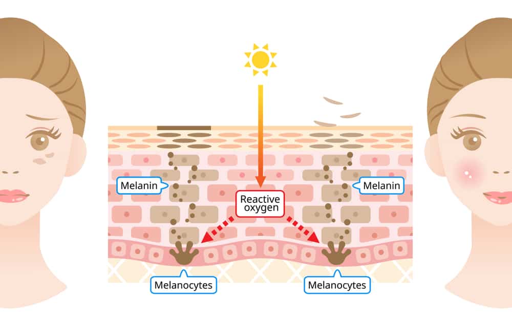  Tranexamic Acid: Thành Phần Trị Nám Hiệu Quả Cho Làn Da Tươi Sáng