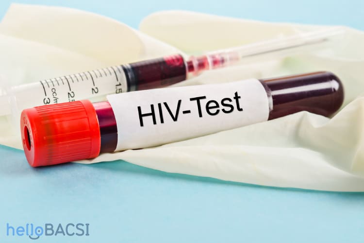  Hướng dẫn toàn diện về xét nghiệm HIV